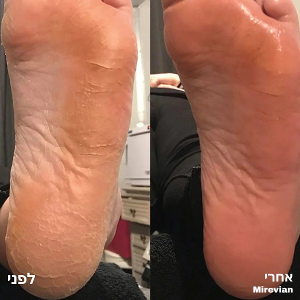 <h2>אל תאמינו לנו, תשמעו את הלקוחות שלנו.</h2>