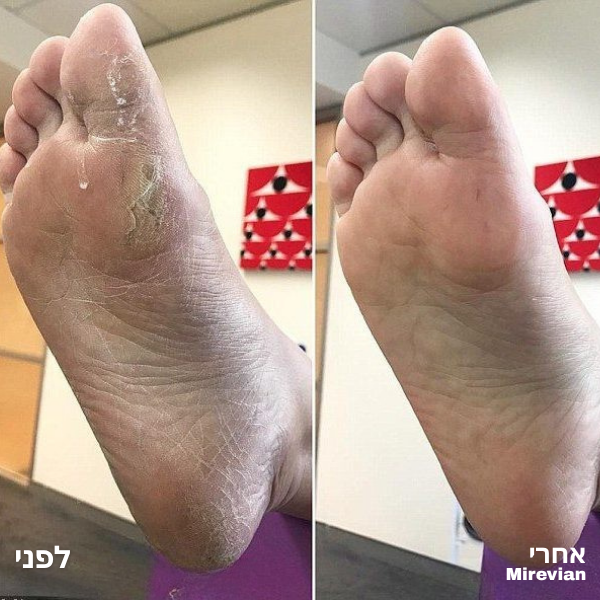 <h2>אל תאמינו לנו, תשמעו את הלקוחות שלנו.</h2>