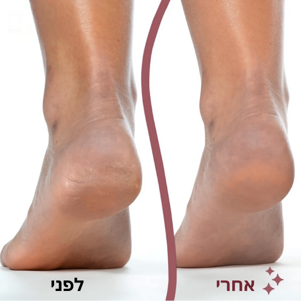 מארז פדיקור (פרימיום) - ™Mirevian